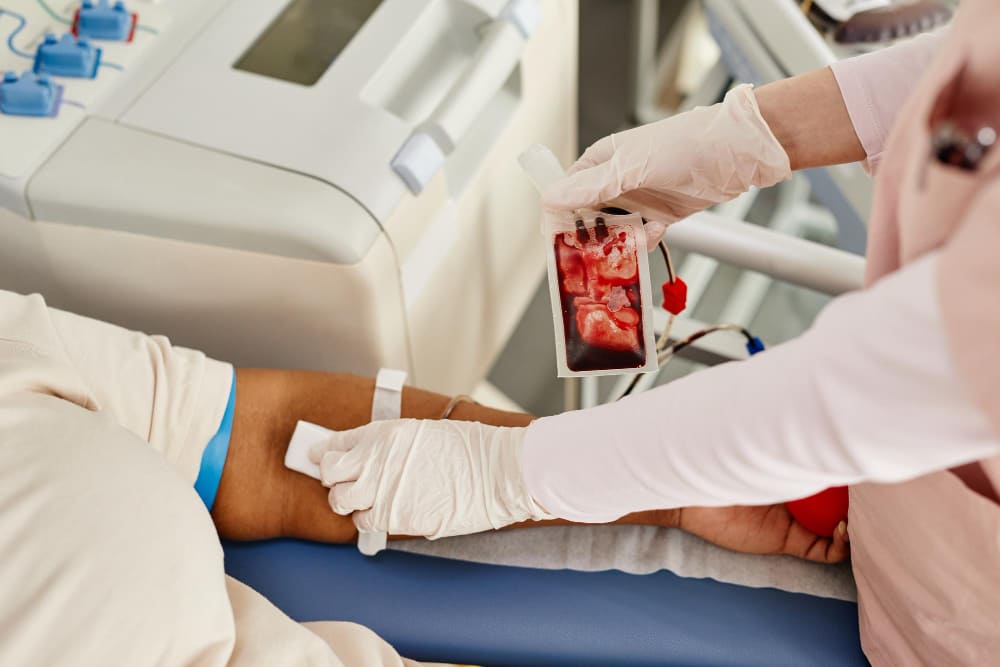 Fístula arteriovenosa para acceso vascular de hemodiálisis en CDMX