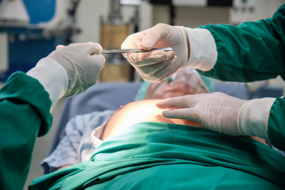 Reconstrucción de pared abdominal por hernias incisionales en CDMX